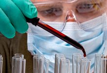 Medical Laboratory Technology MLT Scope In Pakistan, Salary, Courses