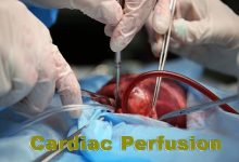 Cardiac Perfusion In Pakistan Scope, Jobs, Salary, Subjects, Universities